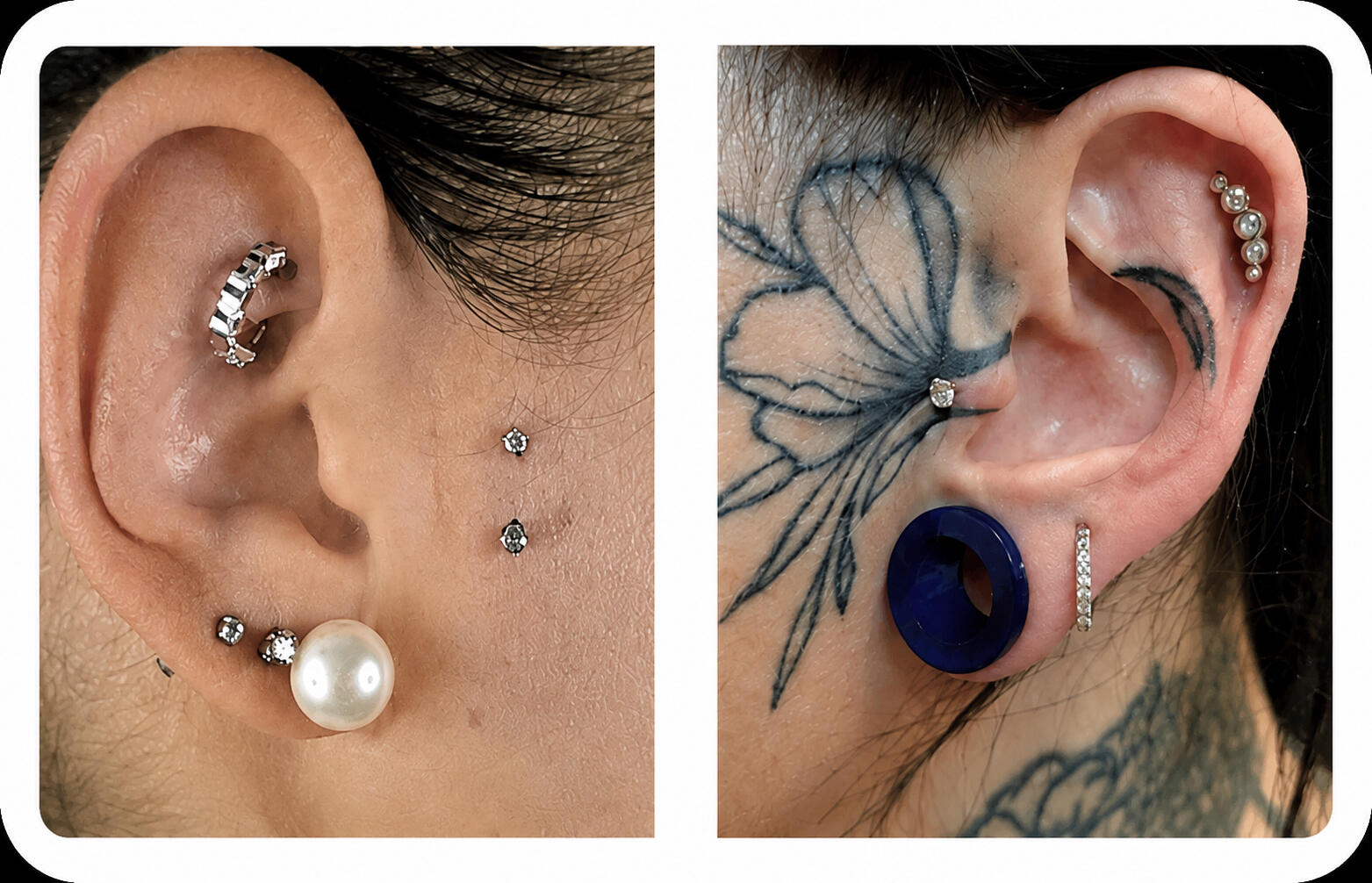 Clinique Zen'Art à Donnacona – services de laser et piercing