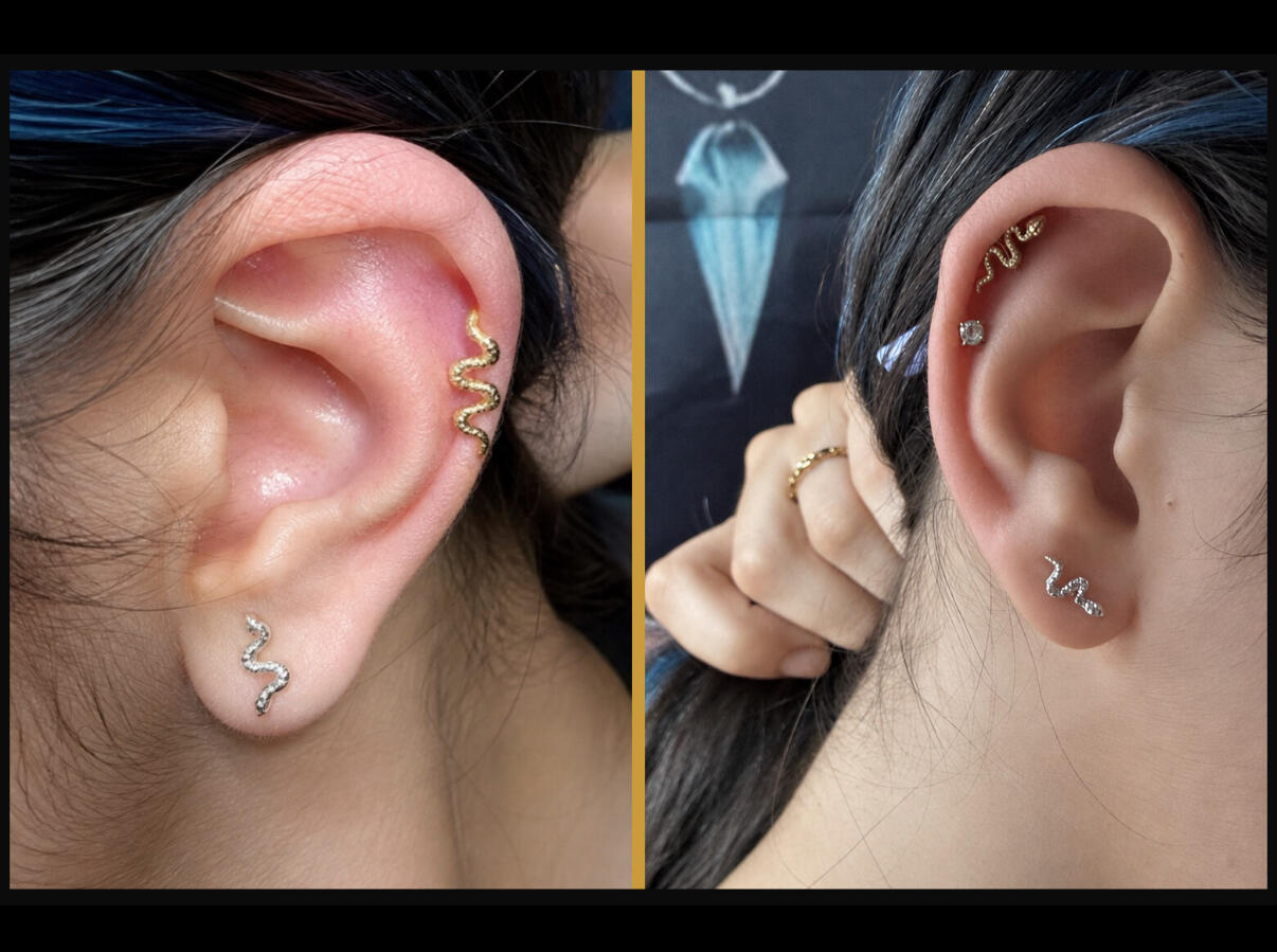 Clinique Zen'Art à Donnacona – services de laser et piercing