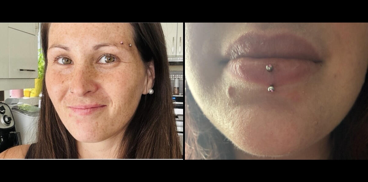 Clinique Zen'Art à Donnacona – services de laser et piercing