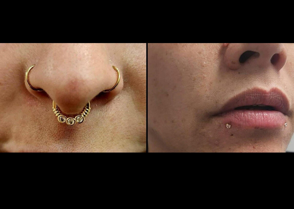 Clinique Zen'Art à Donnacona – services de laser et piercing